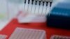 FILE - An employee dilutes poultry serum samples for ELISA test for the detection of antibodies to the avian influenza virus at the Reference Laboratory of the World Organization for Animal Health in Campinas, Brazil April 25, 2023. 