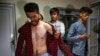 Jurnalis Afghanistan Nematullah Naqdi (kiri) tampak merasa kesakitan ketika dibantu oleh rekannya untuk mengenakan baju setelah ia dilepaskan Taliban dari tahanan pada 8 September 2021. Taliban menangkap Naqdi dan rekannya saat mereka meliput sebuah protes di Kabul. (Foto: AFP)