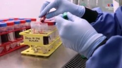 AstraZeneca-ն` կորոնավիրուսի դեմ պատվաստանյութ արտադրելու գլխավոր հավակնորդներից է