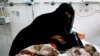 In this Tuesday, March 22, 2016 photo, Udai Faisal, who is suffering acute malnutrition is fed by his mother Intissar Hezzam at al-Sabeen Hospital in Sana'a, Yemen. Hunger has been the most horrific consequence of Yemen’s conflict and has spiraled since Saudi Arabia and its allies, backed by the U.S., launched a campaign of airstrikes and a naval blockade a year ago. 