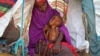 FILE - A displaced Somali mother comforts her malnourished child in their makeshift shelter at a camp in the Garasbaley area on the outskirts of Mogadishu, Somalia, March 28, 2017.